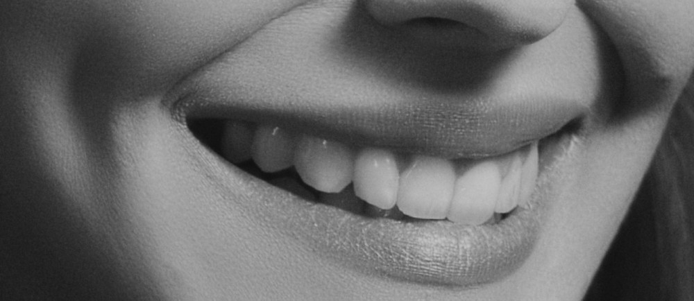 【ホワイトニング】