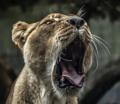 【口腔乾燥症】