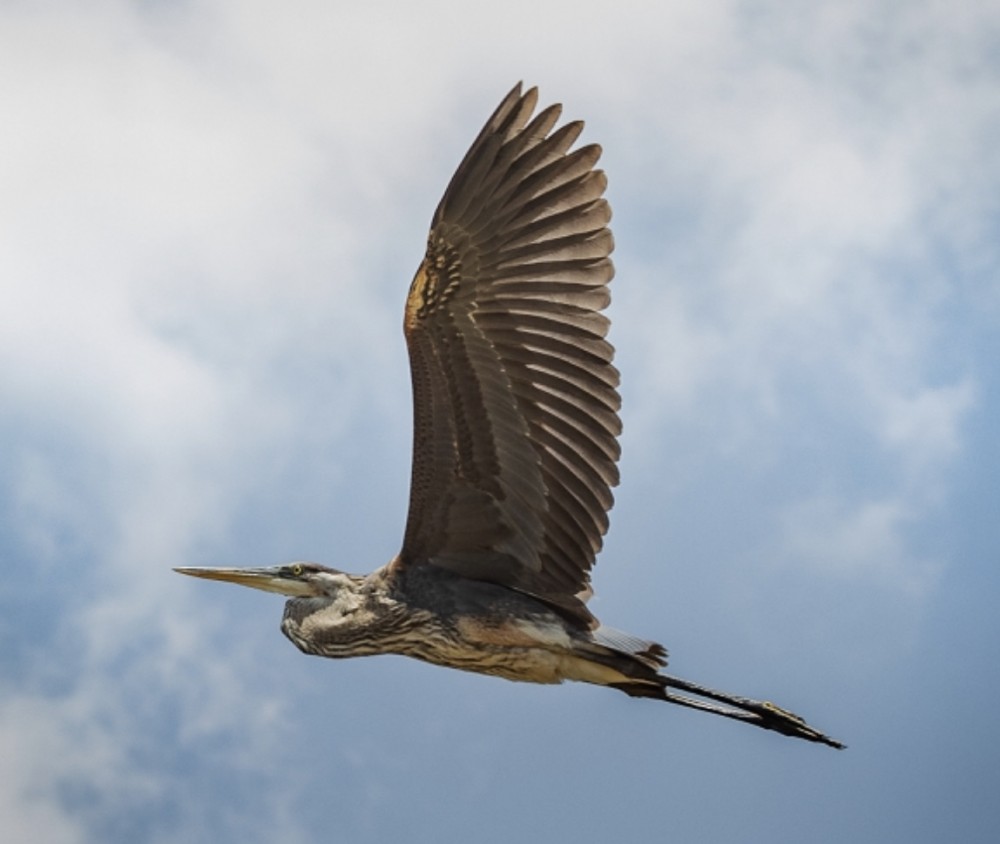 【歯医者が嫌いです】