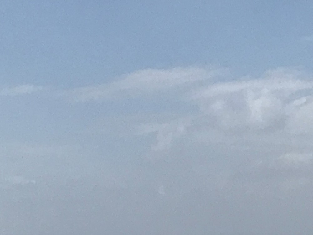 【アゴが外れたら?】