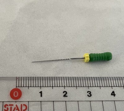 症例紹介【破折したファイルの除去】