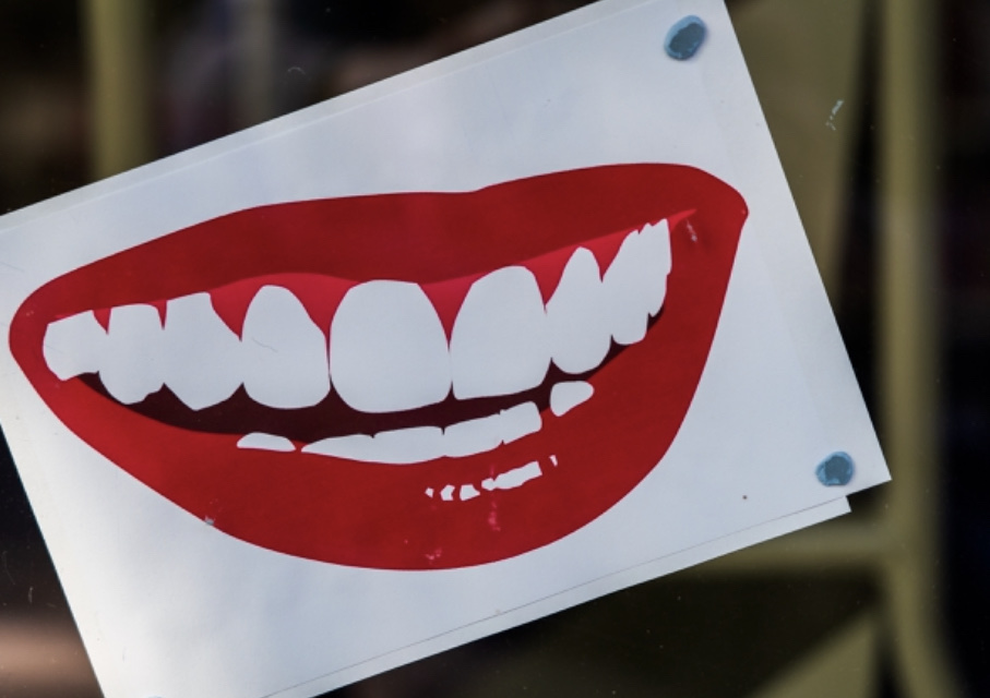 【インスタント仮歯】