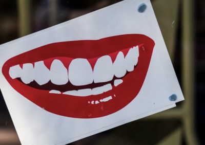 【インスタント仮歯】