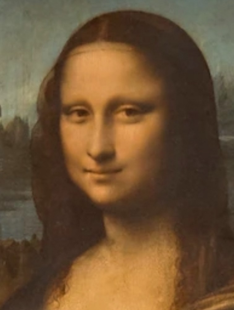 【八重歯について】