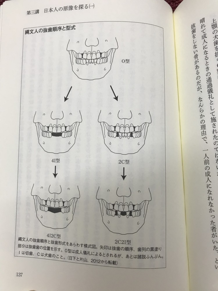 縄文時代の抜歯　その理由