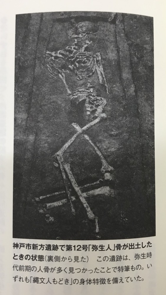 縄文時代の抜歯　その理由