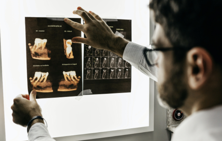 「出来るだけ」歯を削らない