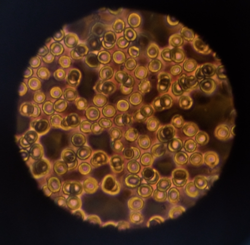 抗生物質を毎日飲んだら体に良い？