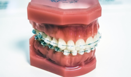 【矯正歯科の選び方】