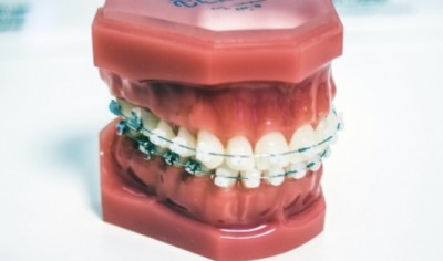 【矯正歯科の選び方】